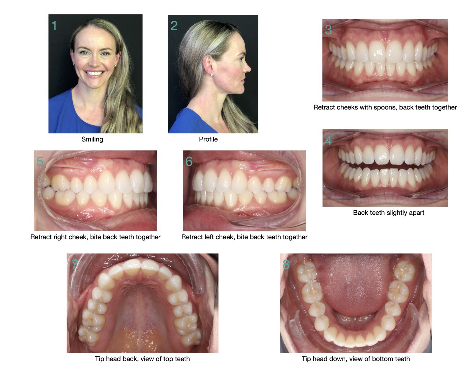 New Patient Composite