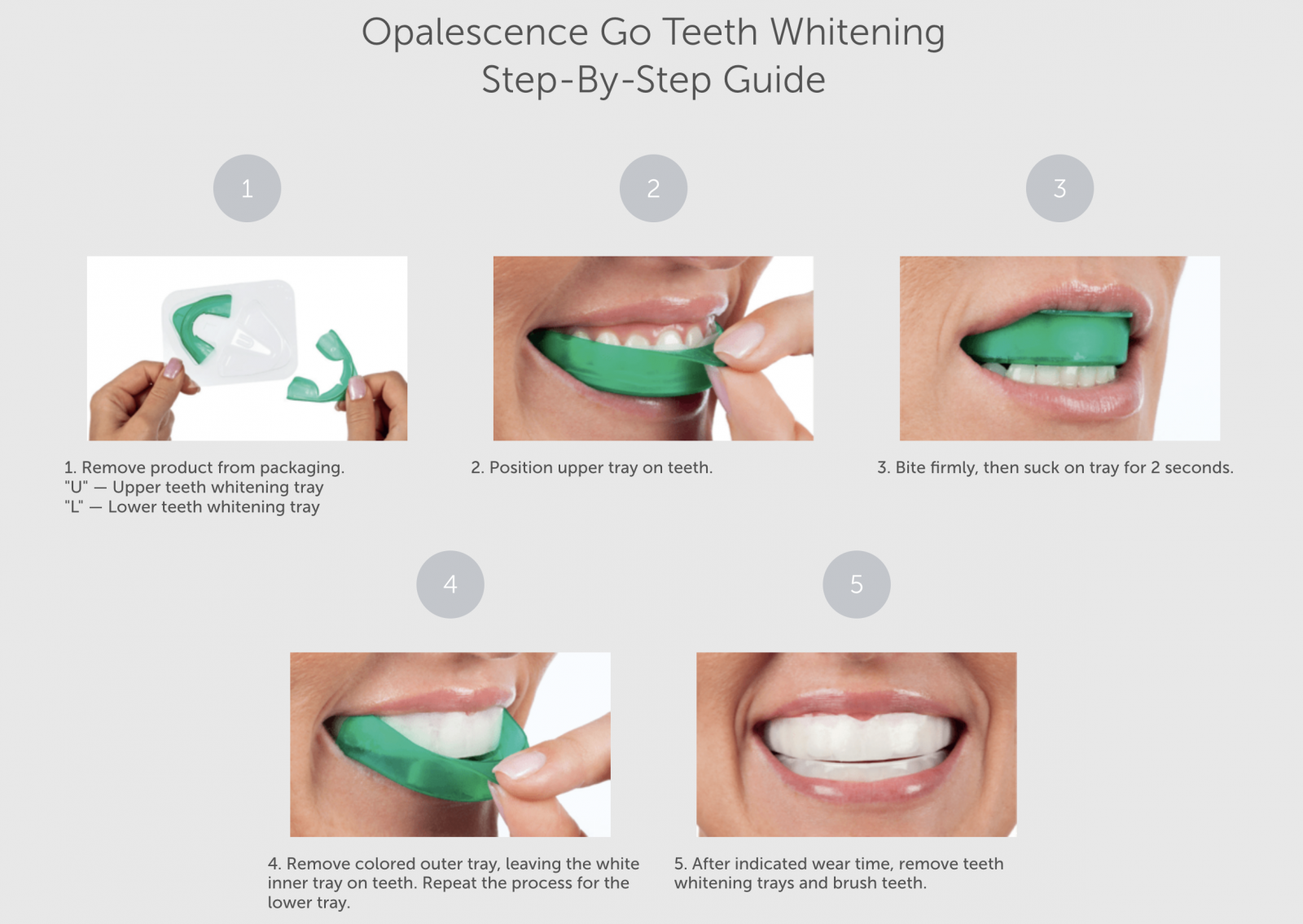 How to Use Opalescence Tooth Whitening - Baird Orthodontics